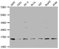 Western Blot
Positive WB detected in: 293T whole cell lysate, U251 whole cell lysate, PC-3 whole cell lysate, Hela whole cell lysate, U87 whole cell lysate, HepG2 whole cell lysate, A549 whole cell lysate
All lanes: FABP4 antibody at 1:1000
Secondary
Goat polyclonal to rabbit IgG at 1/50000 dilution
Predicted band size: 15 kDa
Observed band size: 15 kDa