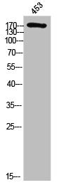 Western Blot analysis of 453 cells using Phospho-EGFR (Y869) Polyclonal Antibody