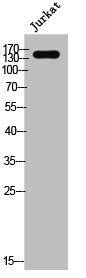 Western Blot analysis of Jurkat cells using EGFR Polyclonal Antibody