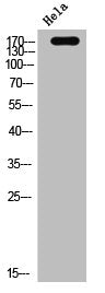 Western Blot analysis of hela cells using EGFR Polyclonal Antibody