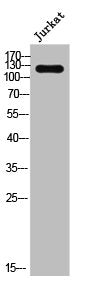 ADCY4 Antibody – Figure 1 of 1