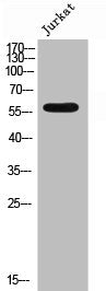 Western Blot analysis of JK cells using Phospho-4.1R (Y660) Polyclonal Antibody