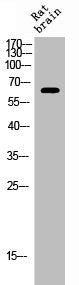 Western Blot analysis of RAT-BRAIN cells using Phospho-ERα (S106) Polyclonal Antibody