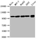 ACTN4 Antibody, Biotin conjugated – Figure 1 of 4
