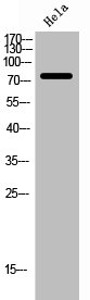 Western Blot analysis of Hela cells using ABCD1 Polyclonal Antibody