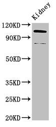 Western Blot
Positive WB detected in: Mouse kidney tissue
All lanes: ACTN4 antibody at 3.4ug/ml
Secondary
Goat polyclonal to rabbit IgG at 1/50000 dilution
Predicted band size: 105, 80, 60 kDa
Observed band size: 105, 80 kDa