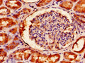 Immunohistochemistry of paraffin-embedded human kidney tissue using CSB-PA008226LA01HU at dilution of 1:100