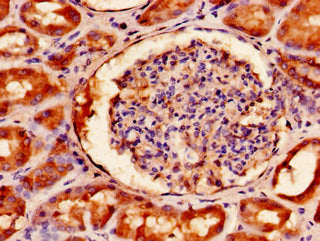 Immunohistochemistry of paraffin-embedded human kidney tissue using CSB-PA008226LA01HU at dilution of 1:100