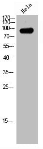 Western Blot analysis of HeLa cells using ABCF1 Polyclonal Antibody