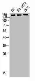 Western blot analysis of KB SH-SY5Y 293T lysis using Flt-1 antibody.