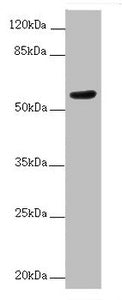 Western blot All lanes: ACVRL1 antibody at 2ug/ml + MCF-7 whole cell lysate Secondary Goat polyclonal to rabbit IgG at 1/10000 dilution Predicted band size: 57 kDa Observed band size: 57 kDa
