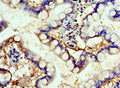 Immunohistochemistry of paraffin-embedded human small intestine tissue using CSB-PA008525ESR1HU at dilution of 1:100
