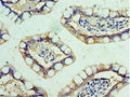 Immunohistochemistry of paraffin-embedded human small intestine tissue using CSB-PA008525ESR2HU at dilution of 1:100