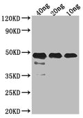 Western Blot
Positive WB detected in Recombinant protein
All lanes: FEN1 antibody at 1:2000
Secondary
Goat polyclonal to rabbit IgG at 1/50000 dilution
Predicted band size: 37.19 kDa
Observed band size: 45 kDa