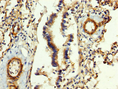 IHC image of CSB-PA008608LA01HU diluted at 1:400 and staining in paraffin-embedded human lung tissue performed on a Leica BondTM system. After dewaxing and hydration, antigen retrieval was mediated by high pressure in a citrate buffer (pH 6.0). Section was blocked with 10% normal goat serum 30min at RT. Then primary antibody (1% BSA) was incubated at 4&deg;C overnight. The primary is detected by a biotinylated secondary antibody and visualized using an HRP conjugated SP system.