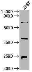 Western Blot
Positive WB detected in: 293T whole cell lysate
All lanes: FGF19 antibody at 1:2000
Secondary
Goat polyclonal to rabbit IgG at 1/50000 dilution
Predicted band size: 25 kDa
Observed band size: 25 kDa
