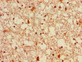Immunohistochemistry of paraffin-embedded human brain tissue using CSB-PA008628LA01HU at dilution of 1:100