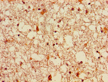 Immunohistochemistry of paraffin-embedded human brain tissue using CSB-PA008628LA01HU at dilution of 1:100