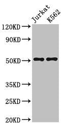Western Blot
Positive WB detected in: Jurkat whole cell lysate, K562 whole cell lysate
All lanes: FLI1 antibody at 3µg/ml
Secondary
Goat polyclonal to rabbit IgG at 1/50000 dilution
Predicted band size: 51, 44, 48, 30 kDa
Observed band size: 51 kDa