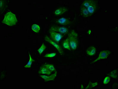 Immunofluorescence staining of MCF-7 cells with CSB-PA008840LA01HU at 1:133, counter-stained with DAPI. The cells were fixed in 4% formaldehyde, permeabilized using 0.2% Triton X-100 and blocked in 10% normal Goat Serum. The cells were then incubated with the antibody overnight at 4°C. The secondary antibody was Alexa Fluor 488-congugated AffiniPure Goat Anti-Rabbit IgG(H+L).