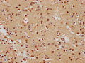 IHC image of CSB-PA008840OA01HU diluted at 1:500 and staining in paraffin-embedded human brain tissue performed on a Leica BondTM system. After dewaxing and hydration, antigen retrieval was mediated by high pressure in a citrate buffer (pH 6.0). Section was blocked with 10% normal goat serum 30min at RT. Then primary antibody (1% BSA) was incubated at 4°C overnight. The primary is detected by a biotinylated secondary antibody and visualized using an HRP conjugated SP system.