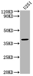 Western Blot
Positive WB detected in: U251 whole cell lysate
All lanes: FST antibody at 1:2000
Secondary
Goat polyclonal to rabbit IgG at 1/50000 dilution
Predicted band size: 39, 35 kDa
Observed band size: 39 kDa