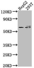 Western Blot
Positive WB detected in: HepG2 whole cell lysate, 293T whole cell lysate
All lanes: FZD7 antibody at 1:2000
Secondary
Goat polyclonal to rabbit IgG at 1/50000 dilution
Predicted band size: 64 kDa
Observed band size: 64 kDa