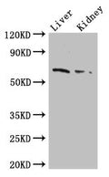 Western Blot
Positive WB detected in: Mouse liver tissue, Mouse kidney tissue
All lanes: FZD9 antibody at 2.5ug/ml
Secondary
Goat polyclonal to rabbit IgG at 1/50000 dilution
Predicted band size: 65 kDa
Observed band size: 65 kDa