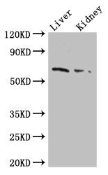 Western Blot
Positive WB detected in: Mouse liver tissue, Mouse kidney tissue
All lanes: FZD9 antibody at 2.5ug/ml
Secondary
Goat polyclonal to rabbit IgG at 1/50000 dilution
Predicted band size: 65 kDa
Observed band size: 65 kDa