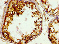 Immunohistochemistry of paraffin-embedded human testis tissue using CSB-PA009190LA01HU at dilution of 1:100