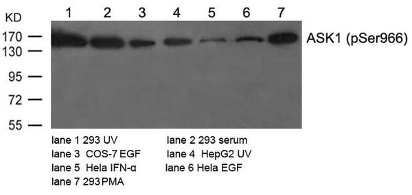 Western blot analysis of extracts from various cells using ASK1(Phospho-Ser966) Antibody.