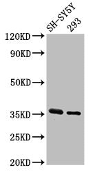 Western Blot
Positive WB detected in: SH-SY5Y whole cell lysate, 293 whole cell lysate
All lanes: GAS1 antibody at 3.2µg/ml
Secondary
Goat polyclonal to rabbit IgG at 1/50000 dilution
Predicted band size: 36 kDa
Observed band size: 36 kDa