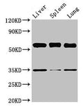 Western Blot
Positive WB detected in: Mouse liver tissue, Mouse spleen tissue, Mouse lung tissue
All lanes: Gba antibody at 3.5µg/ml
Secondary
Goat polyclonal to rabbit IgG at 1/50000 dilution
Predicted band size: 58 kDa
Observed band size: 58 kDa