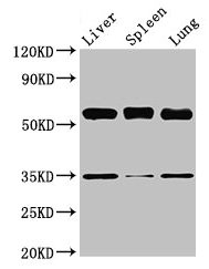 Western Blot
Positive WB detected in: Mouse liver tissue, Mouse spleen tissue, Mouse lung tissue
All lanes: Gba antibody at 3.5µg/ml
Secondary
Goat polyclonal to rabbit IgG at 1/50000 dilution
Predicted band size: 58 kDa
Observed band size: 58 kDa