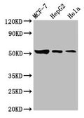 Western Blot
Positive WB detected in: MCF-7 whole cell lysate, HepG2 whole cell lysate, Hela whole cell lysate
All lanes: GBA antibody at 3.6µg/ml
Secondary
Goat polyclonal to rabbit IgG at 1/50000 dilution
Predicted band size: 60, 58, 30, 51, 55 kDa
Observed band size: 51 kDa