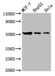 Western Blot
Positive WB detected in: MCF-7 whole cell lysate, HepG2 whole cell lysate, Hela whole cell lysate
All lanes: GBA antibody at 3.6µg/ml
Secondary
Goat polyclonal to rabbit IgG at 1/50000 dilution
Predicted band size: 60, 58, 30, 51, 55 kDa
Observed band size: 51 kDa