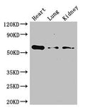 Western Blot
Positive WB detected in: Mouse heart tissue, Mouse lung tissue, Mouse kidney tissue
All lanes: Gcgr antibody at 3ug/ml
Secondary
Goat polyclonal to rabbit IgG at 1/50000 dilution
Predicted band size: 55 kDa
Observed band size: 55 kDa