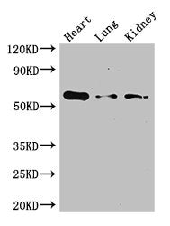 Western Blot
Positive WB detected in: Mouse heart tissue, Mouse lung tissue, Mouse kidney tissue
All lanes: Gcgr antibody at 3ug/ml
Secondary
Goat polyclonal to rabbit IgG at 1/50000 dilution
Predicted band size: 55 kDa
Observed band size: 55 kDa
