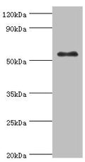 Western blot
All lanes: Glucokinase antibody at 8ug/ml + HepG2 whole cell lysate
Secondary
Goat polyclonal to rabbit IgG at 1/10000 dilution
Predicted band size: 52 kDa
Observed band size: 52 kDa