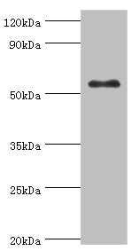 Western blot
All lanes: Glucokinase antibody at 8ug/ml + HepG2 whole cell lysate
Secondary
Goat polyclonal to rabbit IgG at 1/10000 dilution
Predicted band size: 52 kDa
Observed band size: 52 kDa