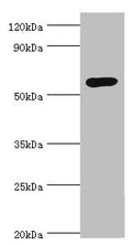 Western blot
All lanes: Glucokinase antibody at 8ug/ml + Jurkat whole cell lysate
Secondary
Goat polyclonal to rabbit IgG at 1/10000 dilution
Predicted band size: 52 kDa
Observed band size: 52 kDa