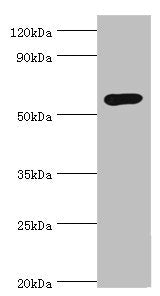 Western blot
All lanes: Glucokinase antibody at 8ug/ml + Jurkat whole cell lysate
Secondary
Goat polyclonal to rabbit IgG at 1/10000 dilution
Predicted band size: 52 kDa
Observed band size: 52 kDa
