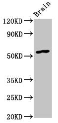 Western Blot
Positive WB detected in: Rat brain tissue
All lanes: GDF10 antibody at 4.5ug/ml
Secondary
Goat polyclonal to rabbit IgG at 1/50000 dilution
Predicted band size: 54 kDa
Observed band size: 54 kDa