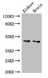 Western Blot
Positive WB detected in: Mouse kidney tissue, Mouse brain tissue
All lanes: GDF11 antibody at 3ug/ml
Secondary
Goat polyclonal to rabbit IgG at 1/50000 dilution
Predicted band size: 46 kDa
Observed band size: 46 kDa