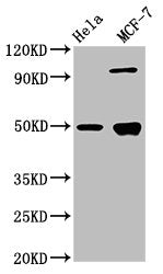 Western Blot
Positive WB detected in: Hela whole cell lysate, MCF-7 whole cell lysate
All lanes: GFAP antibody at 3.9µg/ml
Secondary
Goat polyclonal to rabbit IgG at 1/50000 dilution
Predicted band size: 50, 51 kDa
Observed band size: 50 kDa