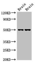 Western Blot
Positive WB detected in: Mouse brain tissue, Rat brain tissue
All lanes: Gfap antibody at 2.7µg/ml
Secondary
Goat polyclonal to rabbit IgG at 1/50000 dilution
Predicted band size: 50, 49 kDa
Observed band size: 50 kDa