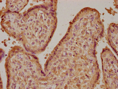 IHC image of CSB-PA009407LA01HU diluted at 1:100 and staining in paraffin-embedded human placenta tissue performed on a Leica BondTM system. After dewaxing and hydration, antigen retrieval was mediated by high pressure in a citrate buffer (pH 6.0). Section was blocked with 10% normal goat serum 30min at RT. Then primary antibody (1% BSA) was incubated at 4°C overnight. The primary is detected by a biotinylated secondary antibody and visualized using an HRP conjugated SP system.