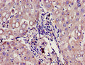 Immunohistochemistry of paraffin-embedded human liver tissue using CSB-PA009411LA01HU at dilution of 1:100