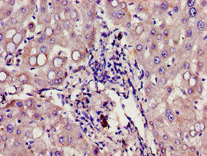Immunohistochemistry of paraffin-embedded human liver tissue using CSB-PA009411LA01HU at dilution of 1:100