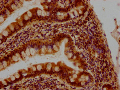 IHC image of CSB-PA009434PA01HU diluted at 1:400 and staining in paraffin-embedded human small intestine tissue performed on a Leica BondTM system. After dewaxing and hydration, antigen retrieval was mediated by high pressure in a citrate buffer (pH 6.0). Section was blocked with 10% normal goat serum 30min at RT. Then primary antibody (1% BSA) was incubated at 4°C overnight. The primary is detected by a biotinylated secondary antibody and visualized using an HRP conjugated SP system.